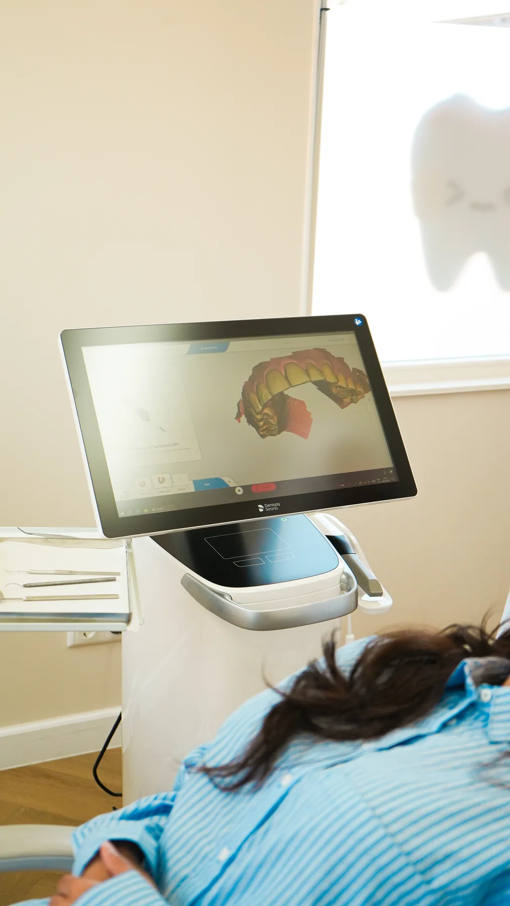 Scherm van de intraorale scanner met een 3D-model van het gebit.